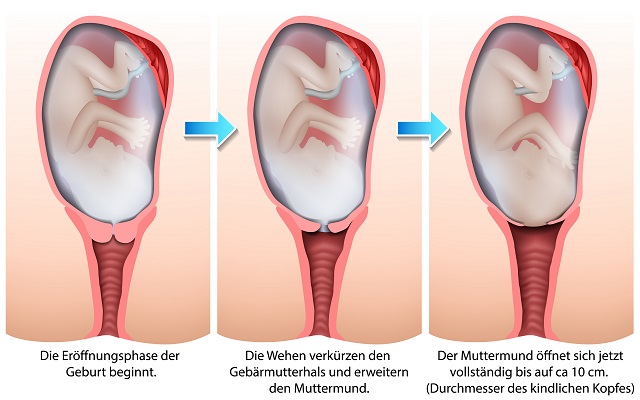 Er�ffnungsphase & �bergangsphase